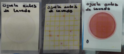 resultados-hisopado-antes-de-limpieza-2