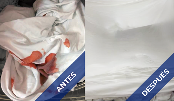 Limpieza eficaz en lavandería hospitalaria: ¿Cómo redujimos costos?